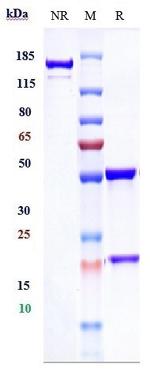 Infliximab Chimeric Antibody in SDS-PAGE (SDS-PAGE)