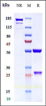alpha Synuclein (Cinpanemab Biosimilar) Antibody in SDS-PAGE (SDS-PAGE)
