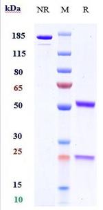 Serum Amyloid P (Dezamizumab Biosimilar) Recombinant Human Monoclonal Antibody
