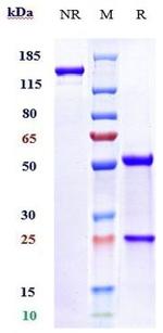VISTA (Onvatilimab Biosimilar) Antibody in SDS-PAGE (SDS-PAGE)