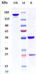 K-cadherin Biosimilar Antibody in SDS-PAGE (SDS-PAGE)