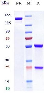 Girentuximab Chimeric Recombinant Human Monoclonal Antibody