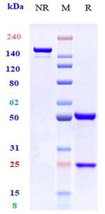 CCR7 Biosimilar Antibody in SDS-PAGE (SDS-PAGE)