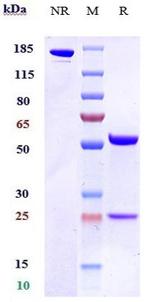 CD200R (Biosimilar) Antibody in SDS-PAGE (SDS-PAGE)