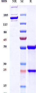 Basiliximab Chimeric Antibody in SDS-PAGE (SDS-PAGE)