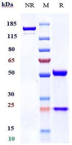 BCMA (Belantamab Biosimilar) Antibody in SDS-PAGE (SDS-PAGE)