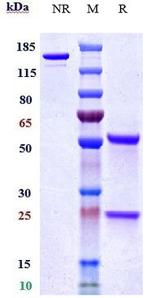 CD40 (Bleselumab Biosimilar) Antibody in SDS-PAGE (SDS-PAGE)