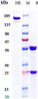 Alemtuzumab Humanized Antibody in SDS-PAGE (SDS-PAGE)