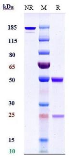 CHI3L1 Chimeric Biosimilar Recombinant Human Monoclonal Antibody