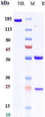 CCL20 Biosimilar Recombinant Human Monoclonal Antibody