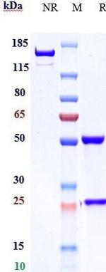EphB4 (Biosimilar) Recombinant Human Monoclonal Antibody