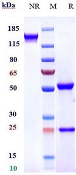 FAP (Sibrotuzumab Biosimilar) Antibody in SDS-PAGE (SDS-PAGE)