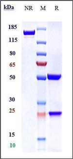 Ferroportin Biosimilar Recombinant Human Monoclonal Antibody