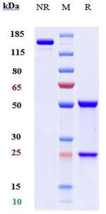 CSF2RA (CD116) (Mavrilimumab Biosimilar) Antibody in SDS-PAGE (SDS-PAGE)