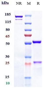GPRC5D (Talquetamab Biosimilar) Antibody in SDS-PAGE (SDS-PAGE)