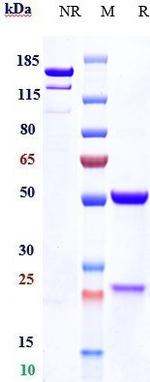 Haptoglobin (Biosimilar) Recombinant Human Monoclonal Antibody