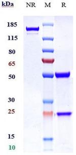 Her-3 (ErbB3) (Patritumab Biosimilar) Antibody in SDS-PAGE (SDS-PAGE)