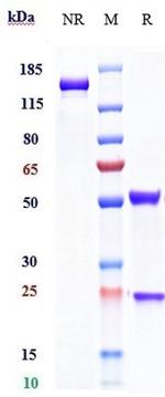 CD25 (Daclizumab Biosimilar) Antibody in SDS-PAGE (SDS-PAGE)