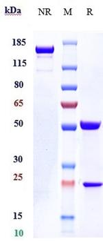 IL31RA (Nemolizumab Biosimilar) Antibody in SDS-PAGE (SDS-PAGE)