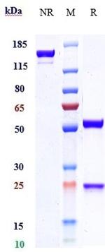 Etokimab Antibody in SDS-PAGE (SDS-PAGE)