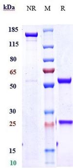 IL4R (Dupilumab Biosimilar) Antibody in SDS-PAGE (SDS-PAGE)
