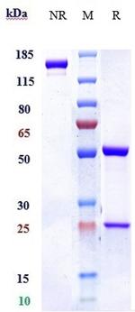 IL-5 (Mepolizumab Biosimilar) Antibody in SDS-PAGE (SDS-PAGE)