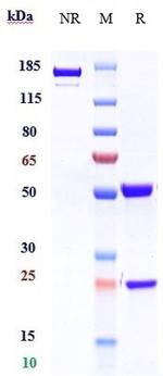 IL5RA (Benralizumab Biosimilar) Antibody in SDS-PAGE (SDS-PAGE)