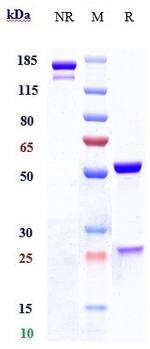 Lewis Y Humanized Biosimilar Recombinant Human Monoclonal Antibody
