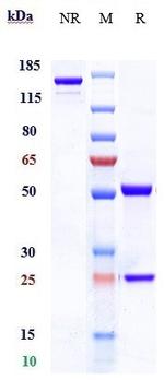 MAG (Refanezumab Biosimilar) Antibody in SDS-PAGE (SDS-PAGE)