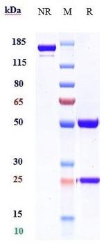 Alirocumab Antibody in SDS-PAGE (SDS-PAGE)