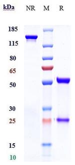 Sacituzumab Humanized Antibody in SDS-PAGE (SDS-PAGE)