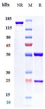 Anifrolumab Antibody in SDS-PAGE (SDS-PAGE)