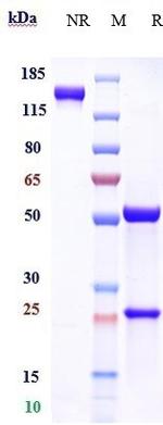 Apolipoprotein J (Sotevtamab Biosimilar) Recombinant Human Monoclonal Antibody