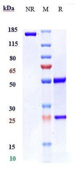 VEGFB (Biosimilar) Recombinant Humanized mouse Monoclonal Antibody