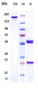 C1QA Biosimilar Antibody in SDS-PAGE (SDS-PAGE)