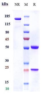 CD131 (CSF2RB) (Trabikibart Biosimilar) Antibody in SDS-PAGE (SDS-PAGE)
