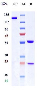 Eblasakimab Antibody in SDS-PAGE (SDS-PAGE)