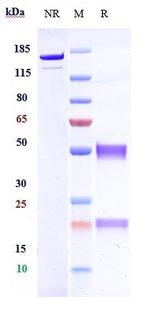 HFE2 (Biosimilar) Recombinant Human Monoclonal Antibody