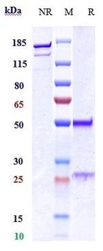 TAT226 (Biosimilar) Recombinant Human Monoclonal Antibody