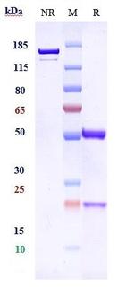 5T4 Humanized Biosimilar Antibody in SDS-PAGE (SDS-PAGE)