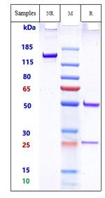 158P1D7 Biosimilar Recombinant Human Monoclonal Antibody