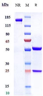 SLC44A4 (Biosimilar) Recombinant Human Monoclonal Antibody