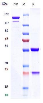 CD70 (Cusatuzumab Biosimilar) Antibody in SDS-PAGE (SDS-PAGE)