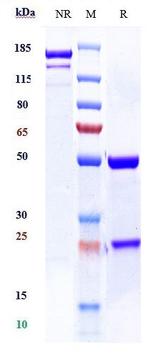 TSH Receptor Biosimilar Recombinant Human Monoclonal Antibody