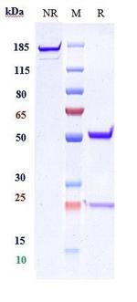 Abrilumab Antibody in SDS-PAGE (SDS-PAGE)