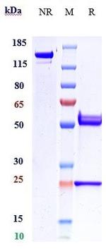 beta Amyloid (DLX212 Biosimilar) Antibody in SDS-PAGE (SDS-PAGE)