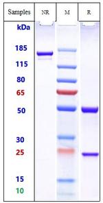 Actoxumab Recombinant Human Monoclonal Antibody