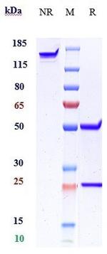 beta Amyloid Humanized Biosimilar Antibody in SDS-PAGE (SDS-PAGE)