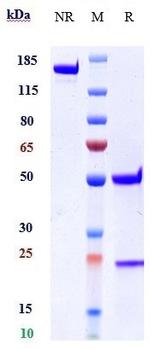 ST2 (Astegolimab Biosimilar) Recombinant Human Monoclonal Antibody