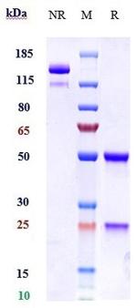 beta-2 Microglobulin/FCRN (Batoclimab Biosimilar) Antibody in SDS-PAGE (SDS-PAGE)